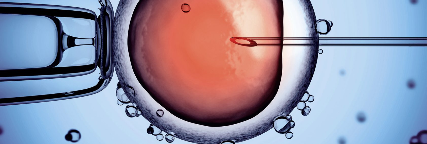 Tout ce qu'il faut savoir sur la fécondation in vitro - Fertilys