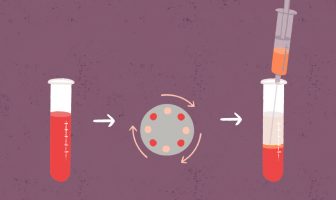 Infusion intra-utérine de Plasma Riche en Plaquettes (PRP)